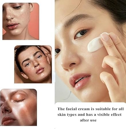 ✨ Spot Fading Urea Cream | 2025 New Vitamin E Urea Cream 💧 |  /50 g Hydrating & Nourishing Moisturizer